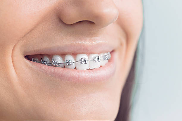Best Full Mouth Reconstruction  in Vero Beach, FL